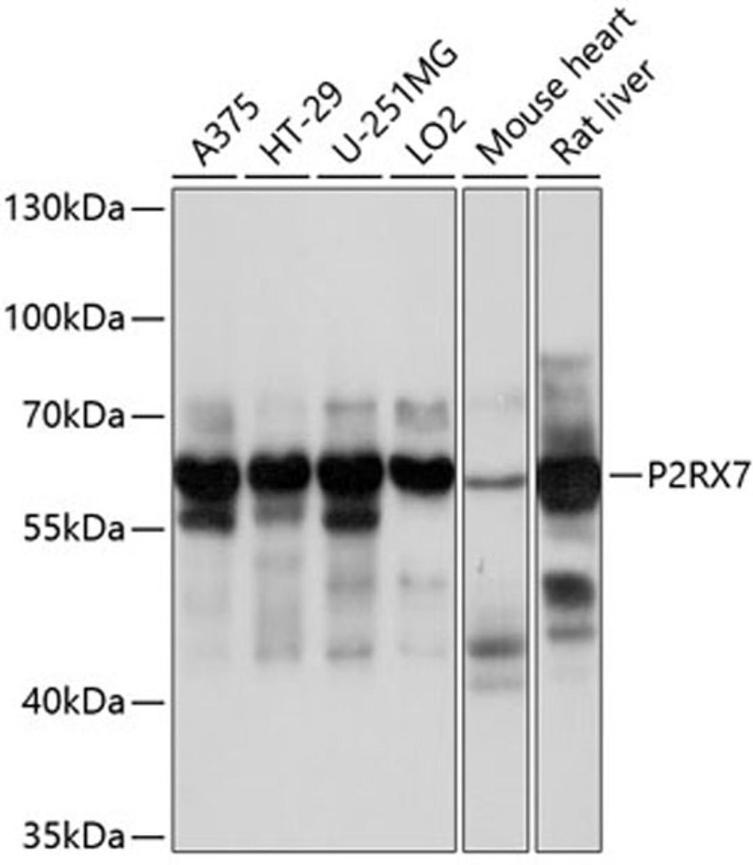 Western blot - P2RX7 antibody (A10511)