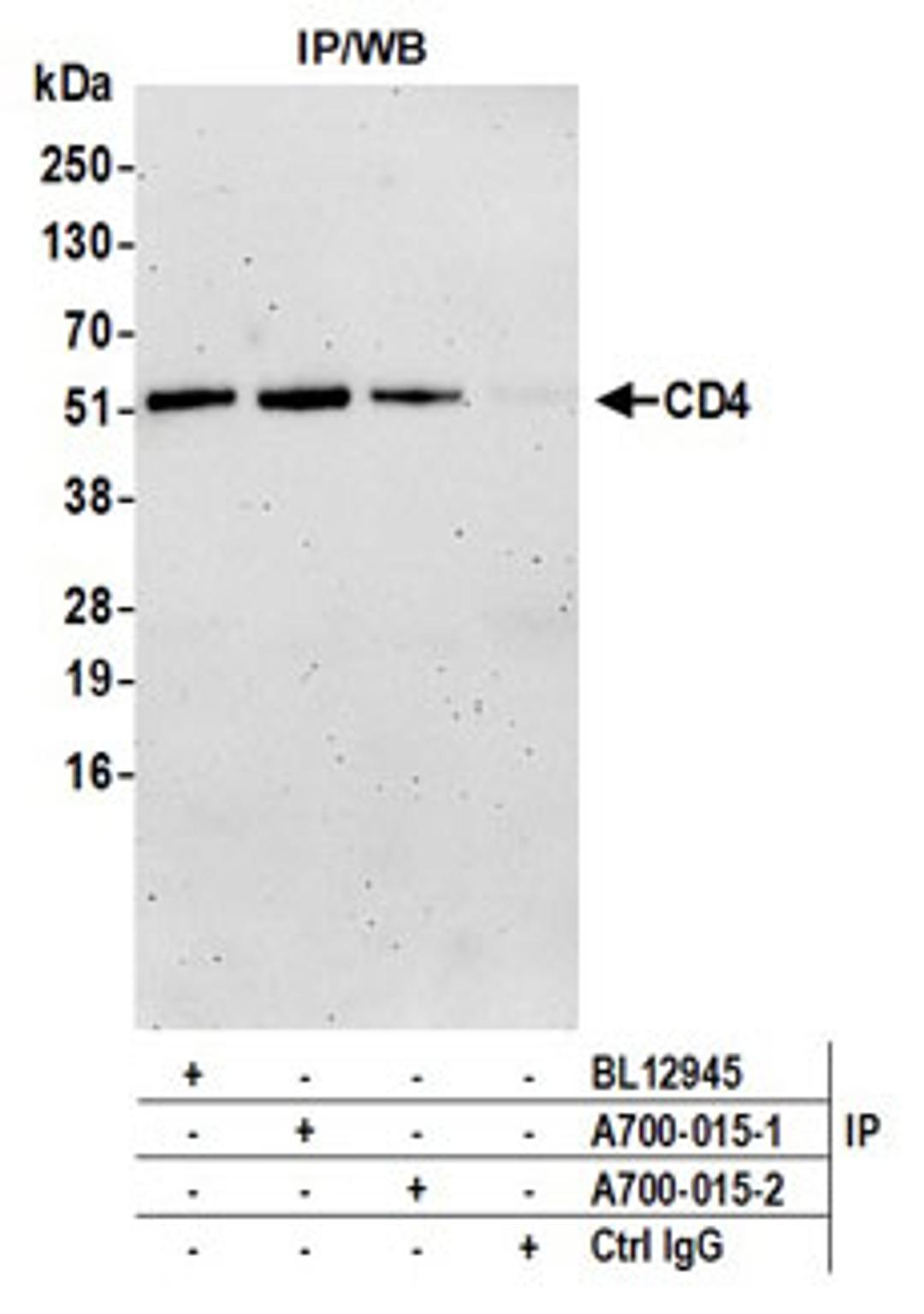 Detection of human CD4 by western blot of immunoprecipitates.