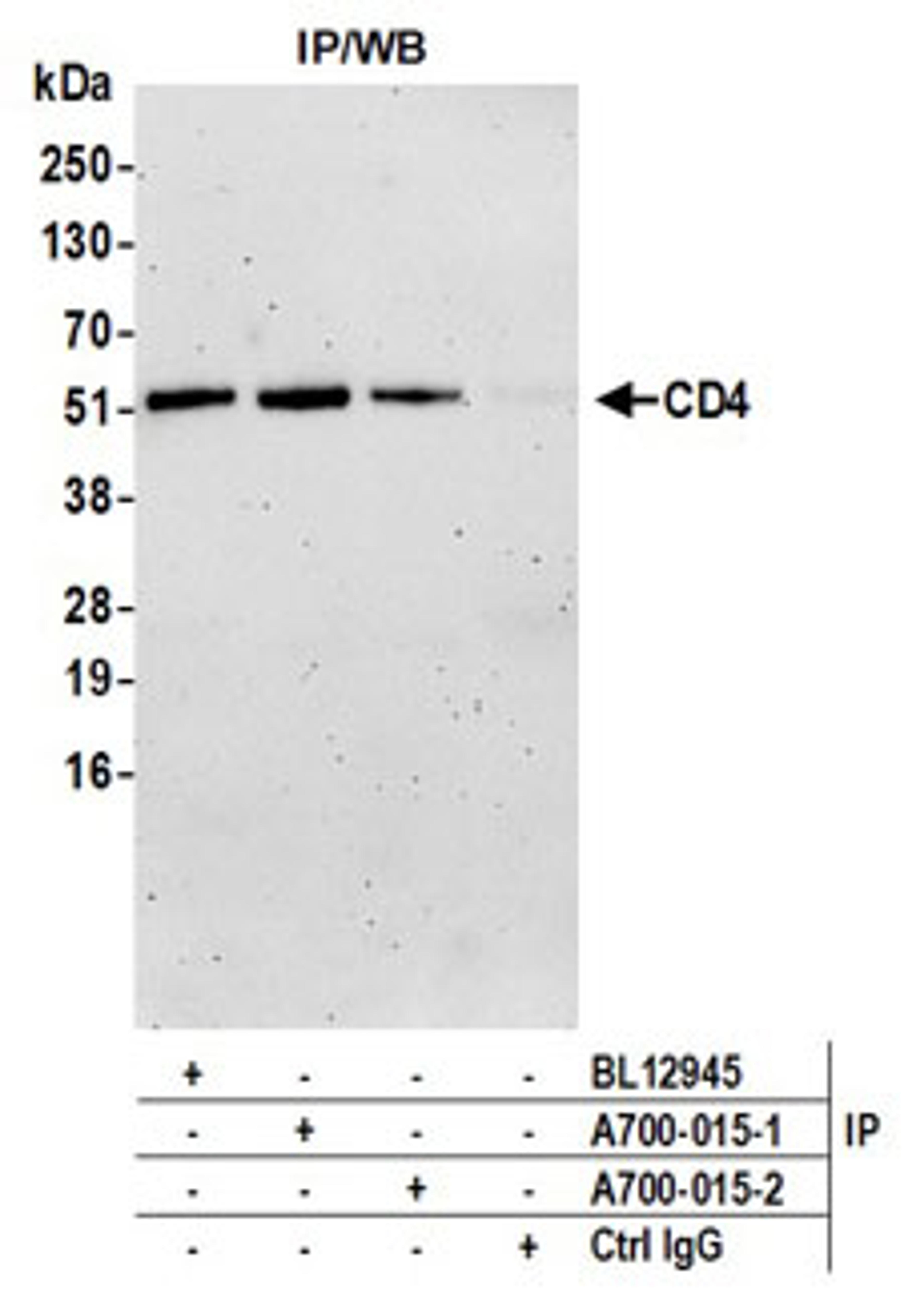 Detection of human CD4 by western blot of immunoprecipitates.