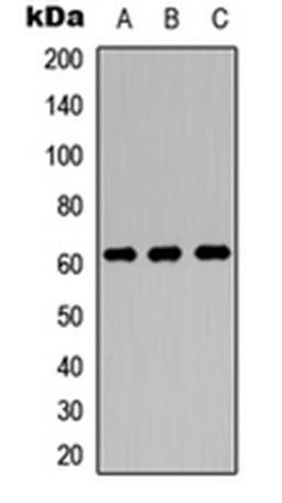 Western blot analysis of MCF7 (Lane 1), NS-1 (Lane 2), PC12 (Lane 3) whole cell lysates using OCTN1 antibody