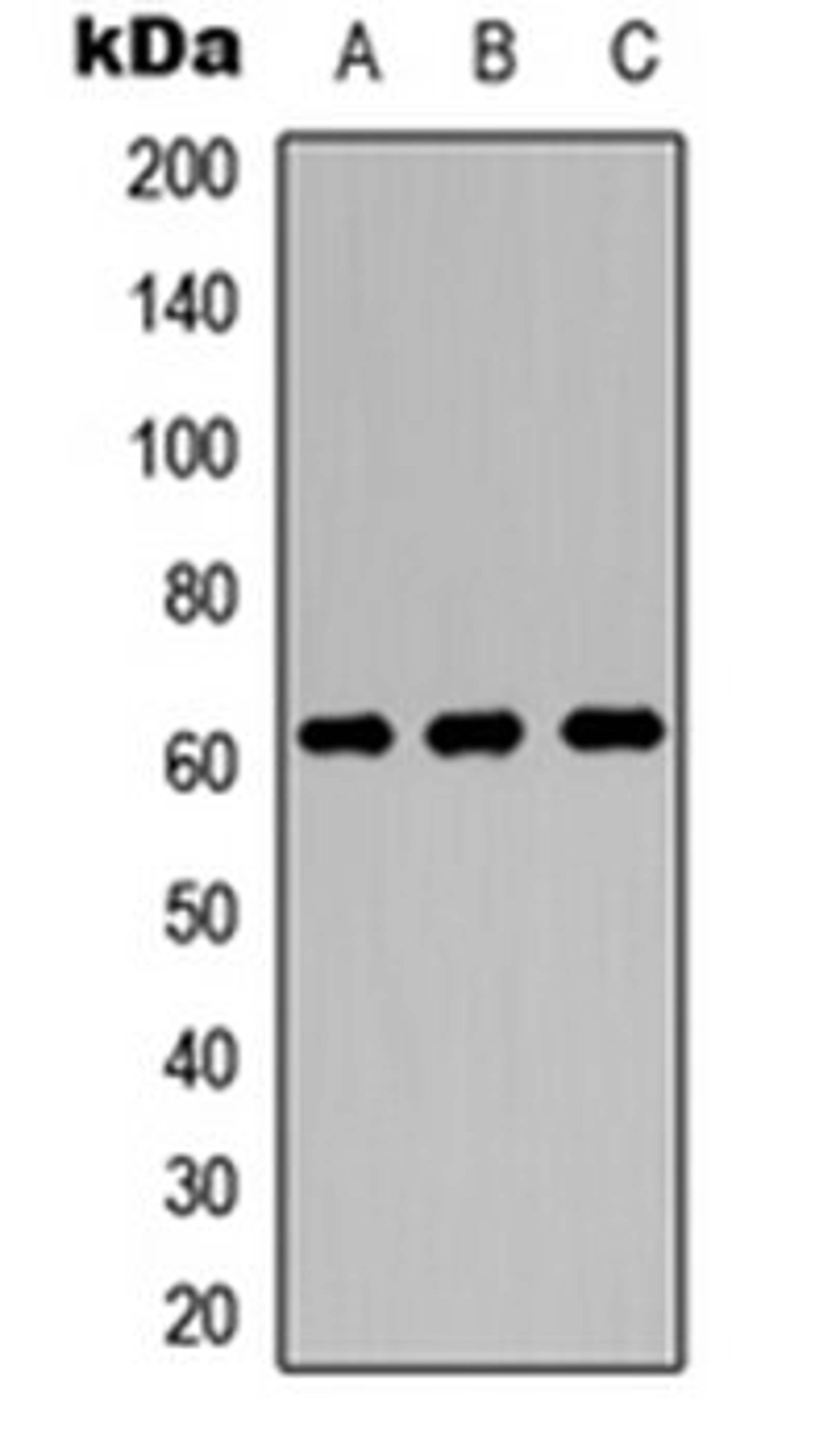 Western blot analysis of MCF7 (Lane 1), NS-1 (Lane 2), PC12 (Lane 3) whole cell lysates using OCTN1 antibody