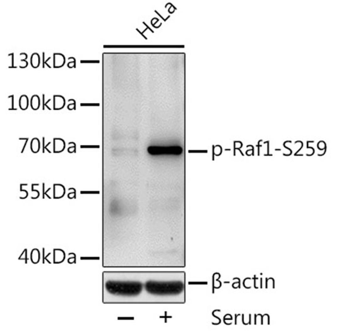 Western blot - Phospho-Raf1-S259 antibody (AP0497)