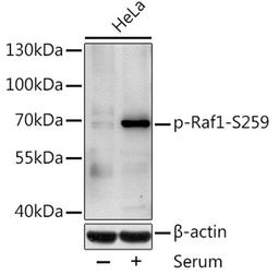 Western blot - Phospho-Raf1-S259 antibody (AP0497)