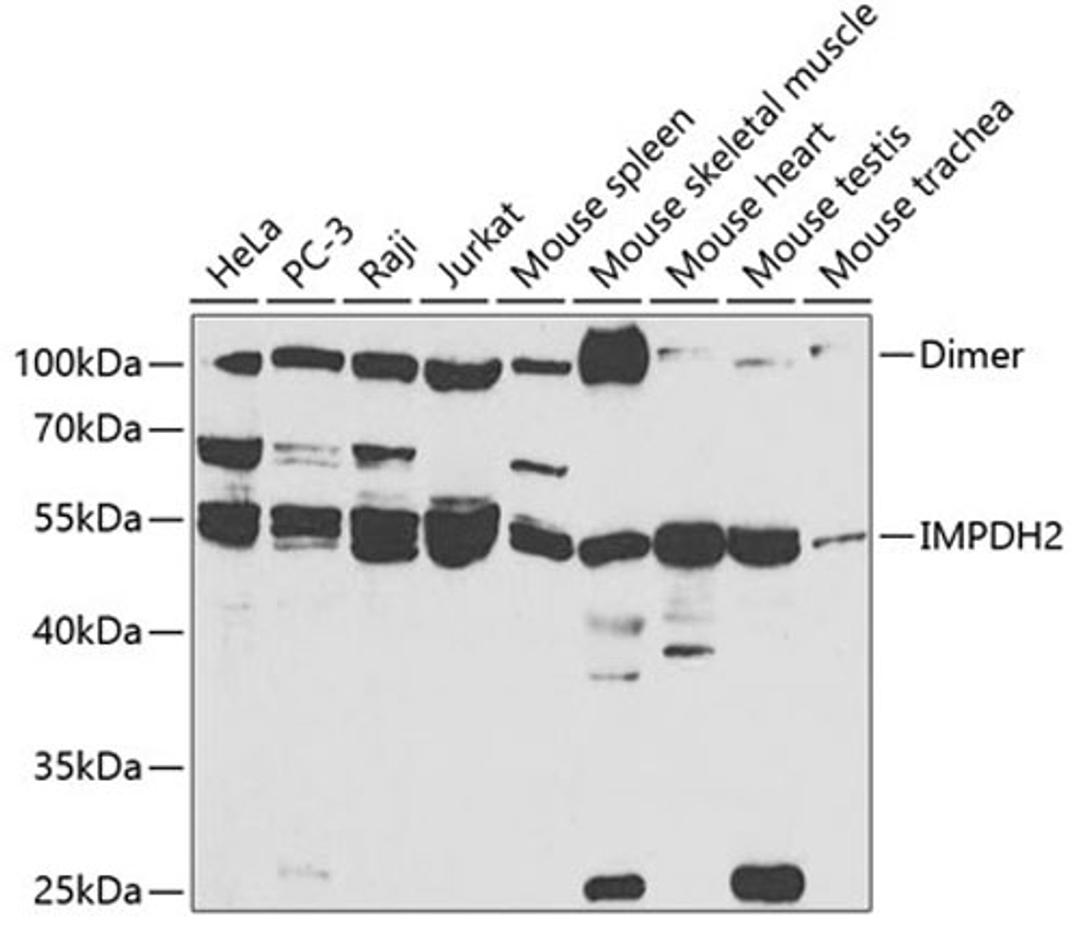 Western blot - IMPDH2 antibody (A5350)