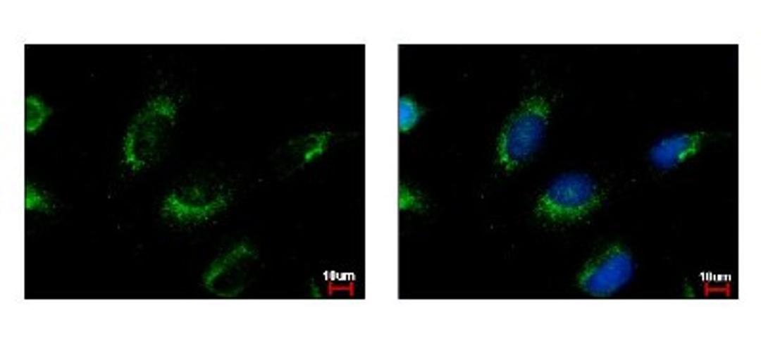 Immunocytochemistry/Immunofluorescence: RNMT Antibody [NBP1-31202] - Sample: HeLa cells were fixed in iced-cold MeOH for 5 min. Green: MET protein stained by MET antibody, C-term diluted at 1:500. Blue: Hoechst 33343 staining.