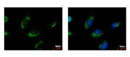 Immunocytochemistry/Immunofluorescence: RNMT Antibody [NBP1-31202] - Sample: HeLa cells were fixed in iced-cold MeOH for 5 min. Green: MET protein stained by MET antibody, C-term diluted at 1:500. Blue: Hoechst 33343 staining.