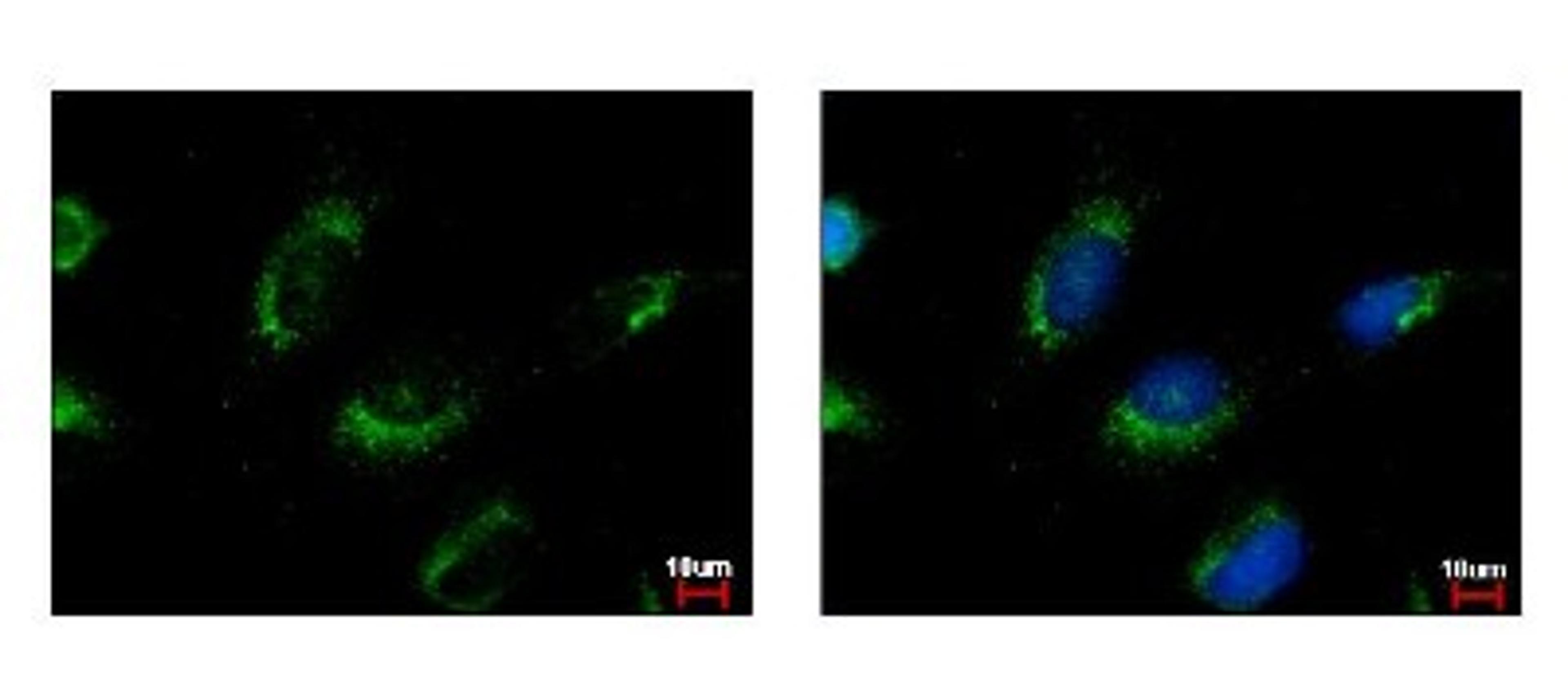 Immunocytochemistry/Immunofluorescence: RNMT Antibody [NBP1-31202] - Sample: HeLa cells were fixed in iced-cold MeOH for 5 min. Green: MET protein stained by MET antibody, C-term diluted at 1:500. Blue: Hoechst 33343 staining.