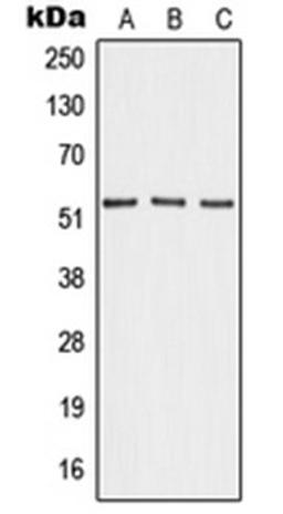 Western blot analysis of HEK293T (Lane 1), mouse lung (Lane 2), PC12 (Lane 3) whole cell lysates using ANGPT4 antibody