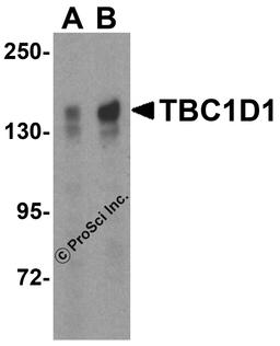 Western blot analysis of TBC1D1 expression in (A) 293 and (B) Daudi cell lysate with TBC1D1 antibody at 2 μg/ml.