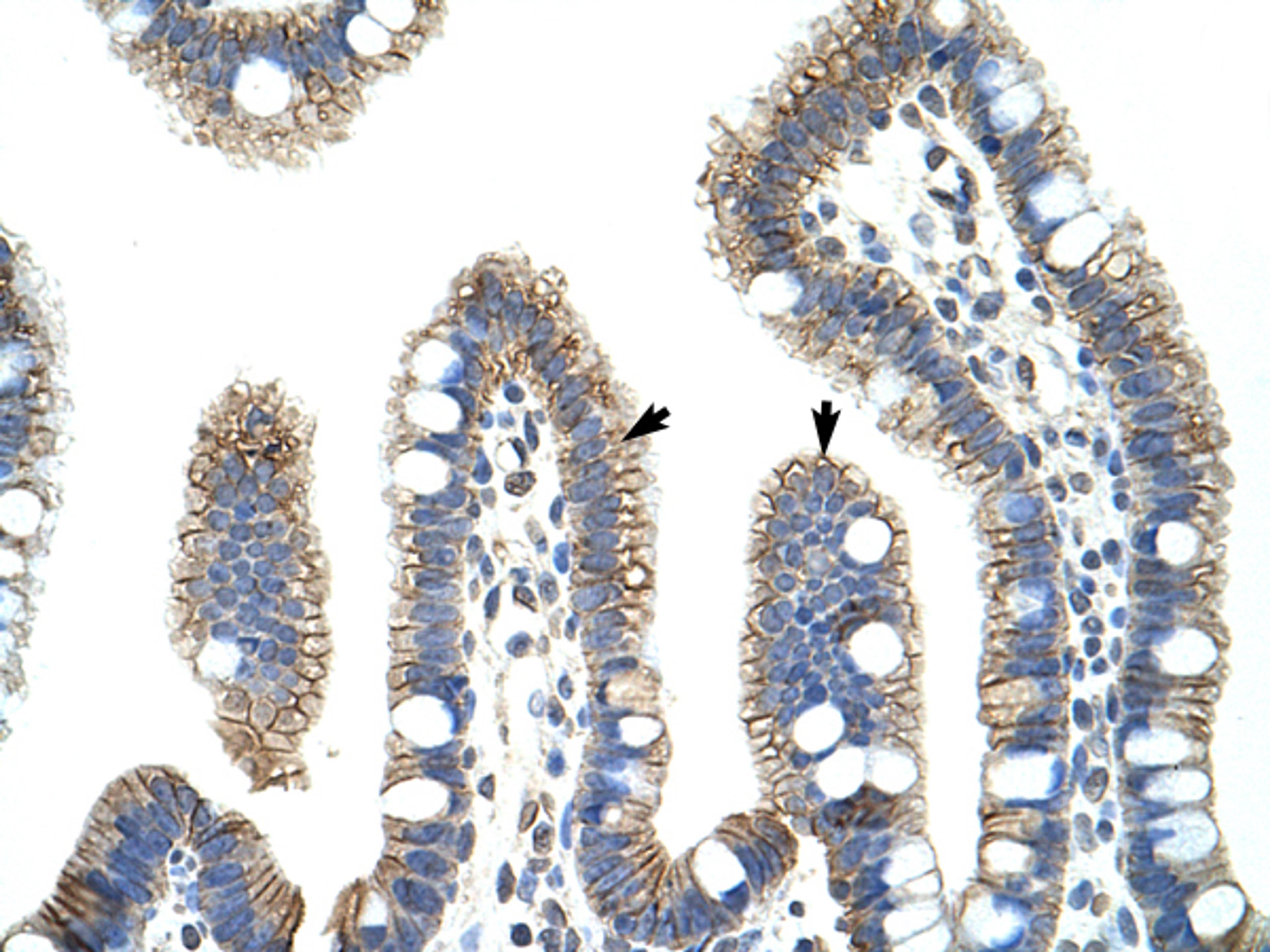 Antibody used in IHC on Human Intestine.