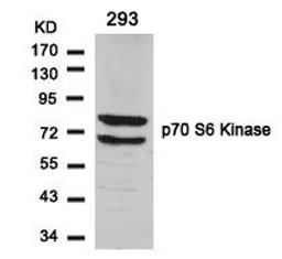 Western blot analysis of lysed extracts from 293 cells using p70 S6 Kinase (Ab-424).