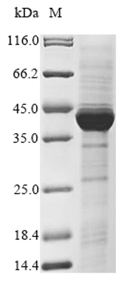 (Tris-Glycine gel) Discontinuous SDS-PAGE (reduced) with 5% enrichment gel and 15% separation gel.