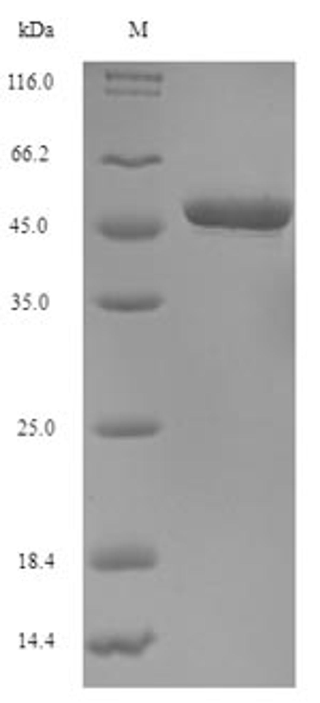 (Tris-Glycine gel) Discontinuous SDS-PAGE (reduced) with 5% enrichment gel and 15% separation gel.