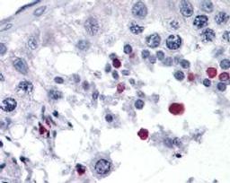 Immunohistochemistry staining of SPANXC in testis tissue using SPANXC Antibody.