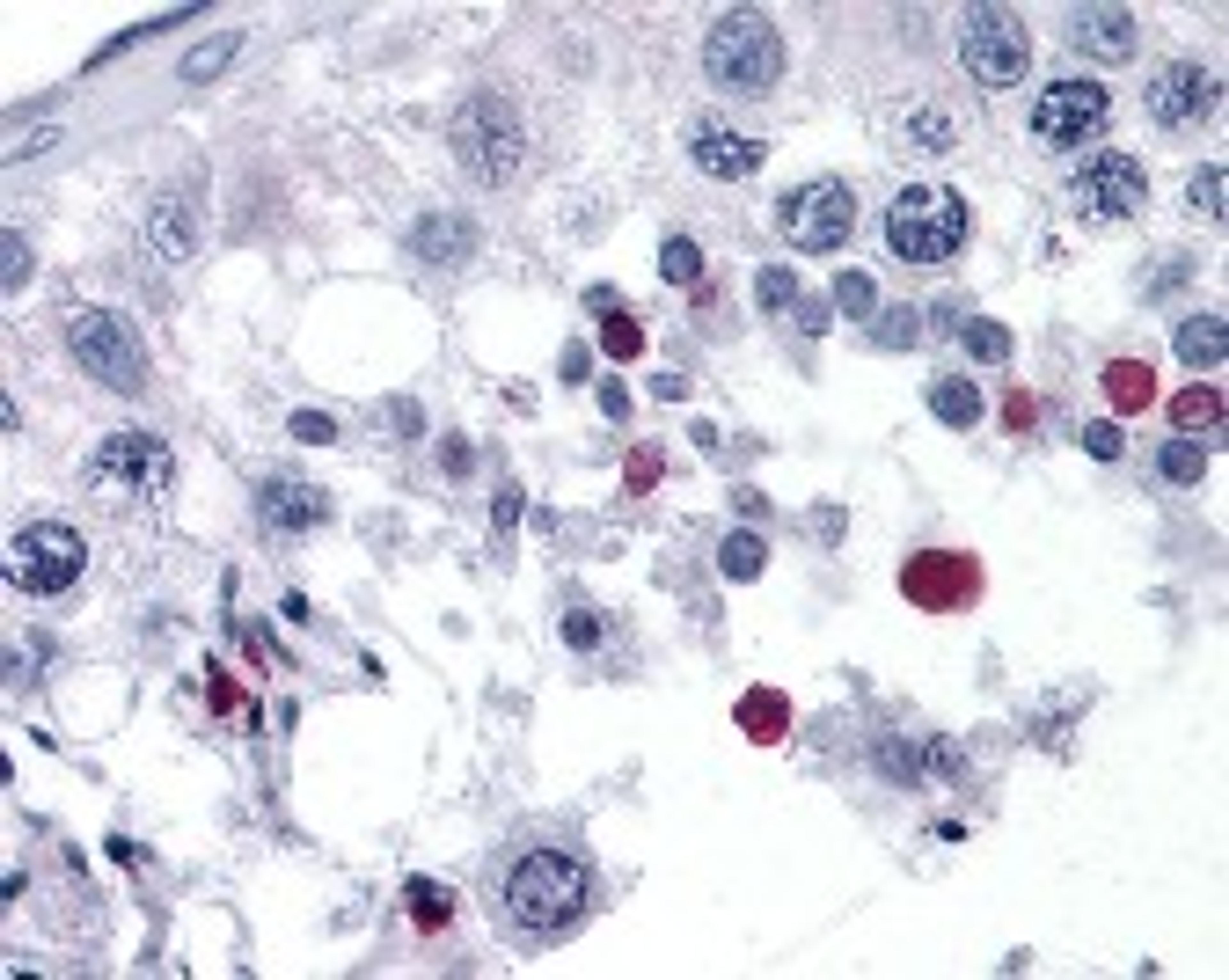 Immunohistochemistry staining of SPANXC in testis tissue using SPANXC Antibody.