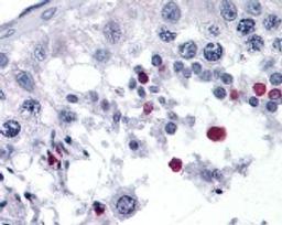 Immunohistochemistry staining of SPANXC in testis tissue using SPANXC Antibody.