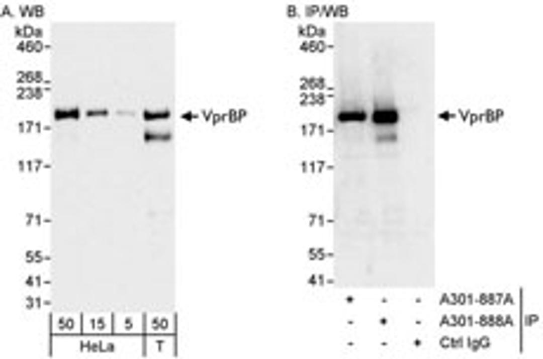 Detection of human VprBP by western blot and immunoprecipitation.