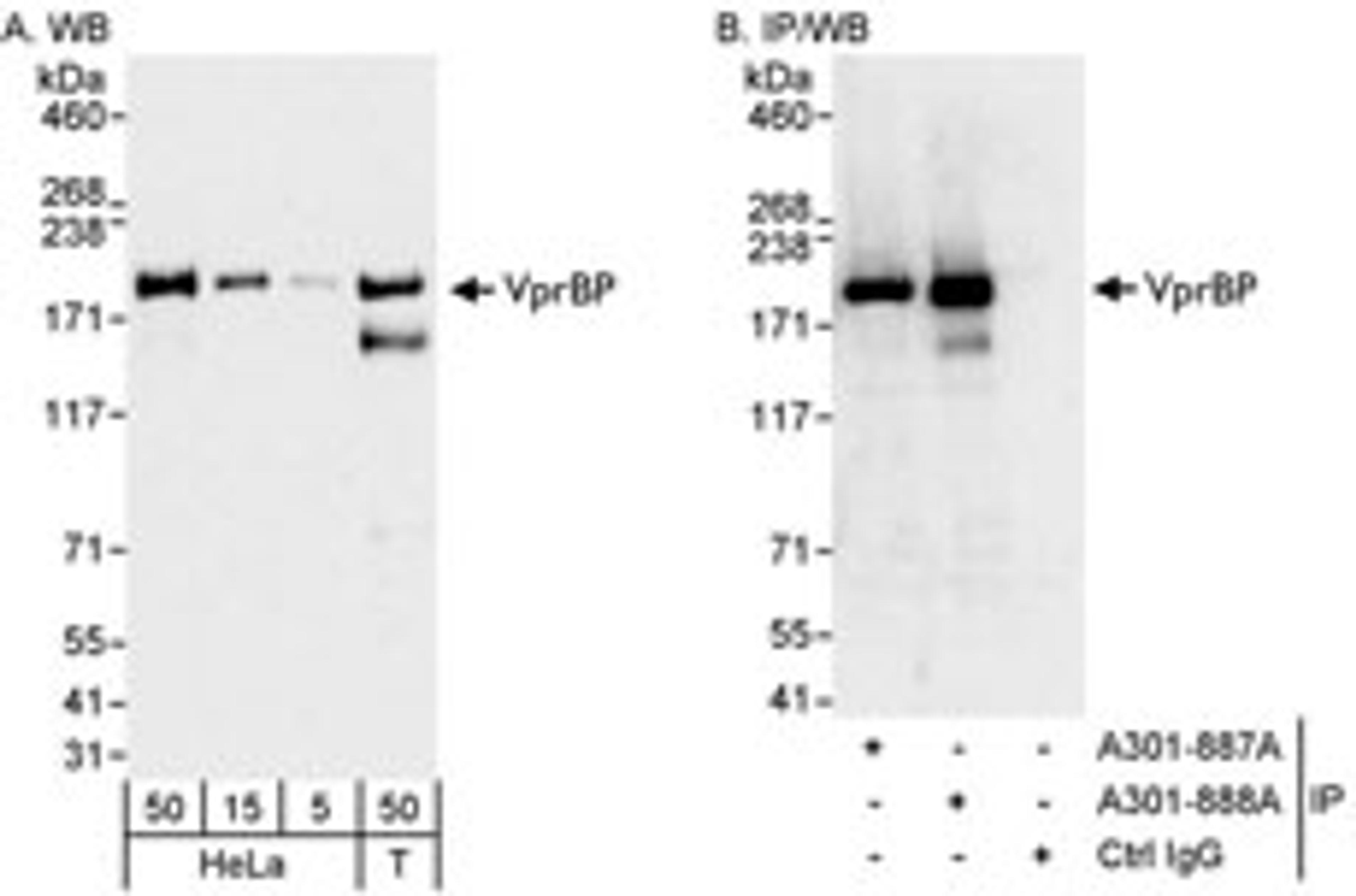 Detection of human VprBP by western blot and immunoprecipitation.