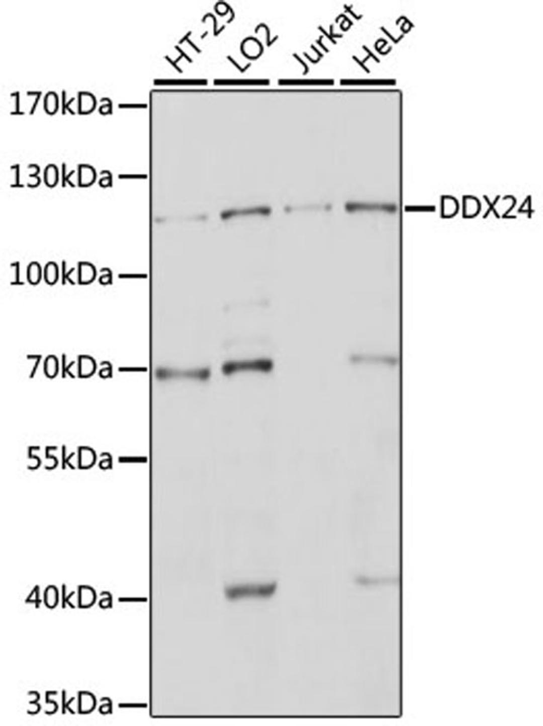 Western blot - DDX24 antibody (A15481)