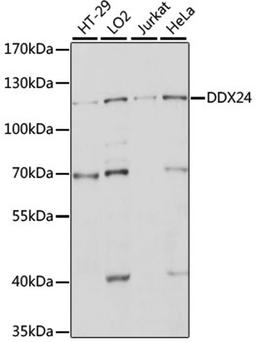 Western blot - DDX24 antibody (A15481)