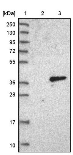 Western Blot: Protease Inhibitor 15 Antibody [NBP1-82445] - Lane 1: Marker [kDa] 250, 130, 95, 72, 55, 36, 28, 17, 10<br/>Lane 2: Negative control (vector only transfected HEK293T lysate)<br/>Lane 3: Over-expression lysate (Co-expressed with a C-terminal myc-DDK tag (~3.1 kDa) in mammalian HEK293T cells, LY414340)