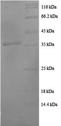 (Tris-Glycine gel) Discontinuous SDS-PAGE (reduced) with 5% enrichment gel and 15% separation gel.