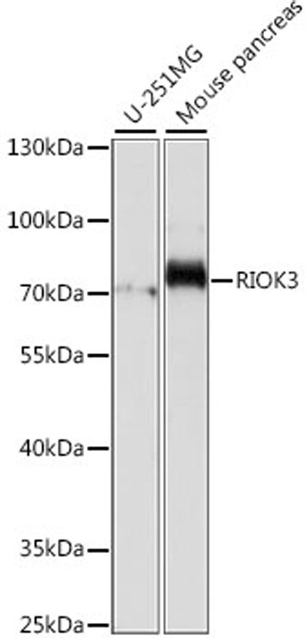 Western blot - RIOK3 antibody (A15744)