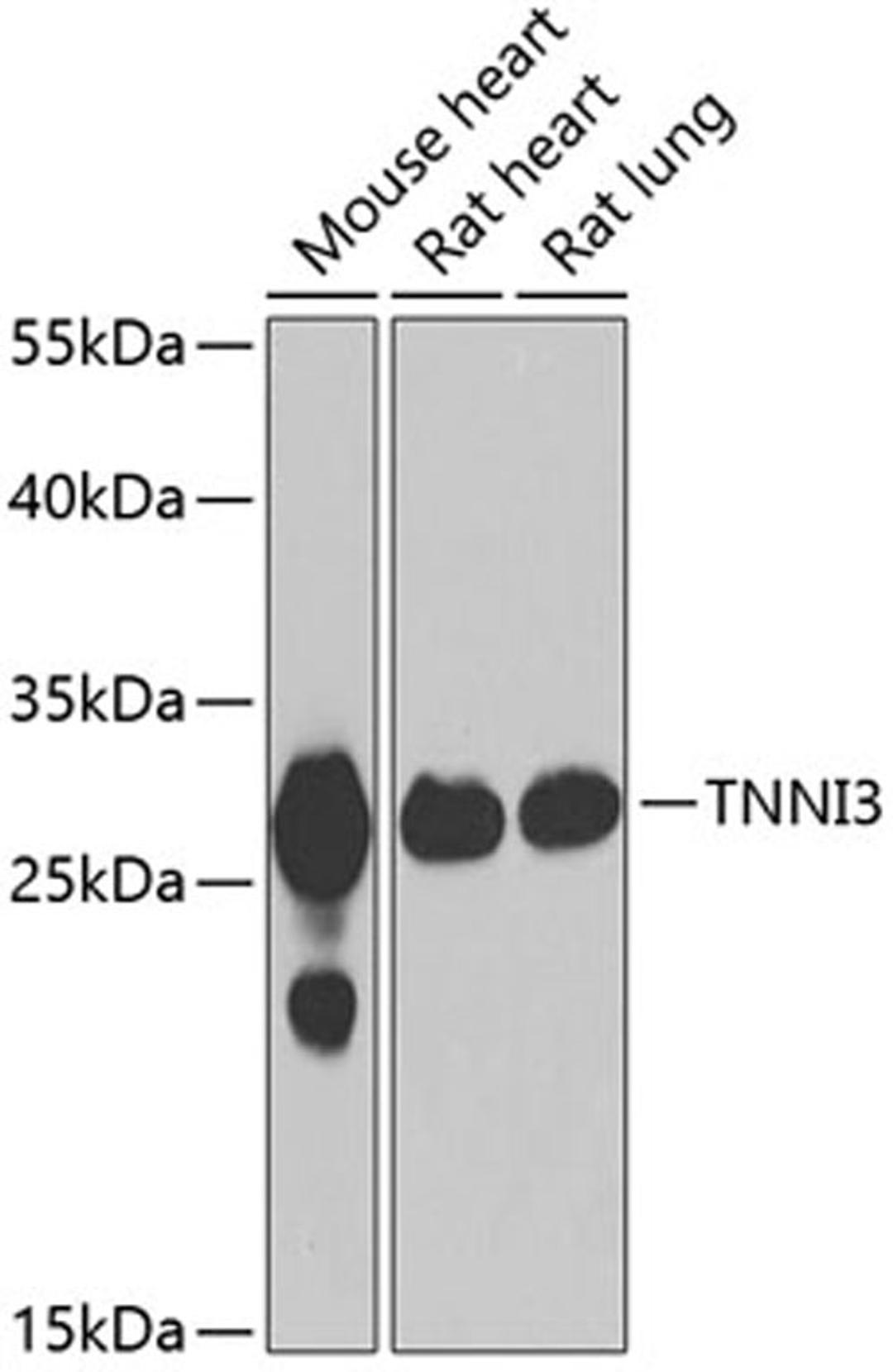 Western blot - TNNI3 antibody (A6995)