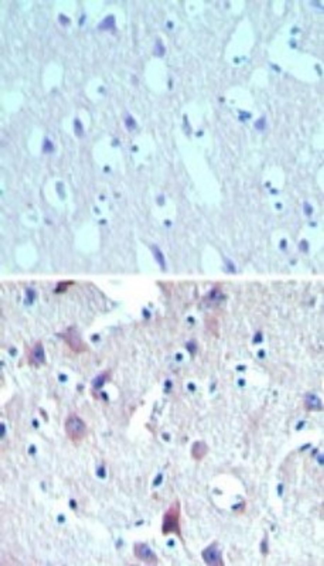 Immunohistochemistry-Paraffin: C8orf55 Antibody [NBP2-24492] - Analysis of DSCD75 in paraffin-embedded formalin-fixed human brain tissue using an isotype control (top) and this antibody (bottom) at 5 ug/ml.