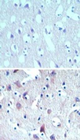 Immunohistochemistry-Paraffin: C8orf55 Antibody [NBP2-24492] - Analysis of DSCD75 in paraffin-embedded formalin-fixed human brain tissue using an isotype control (top) and this antibody (bottom) at 5 ug/ml.