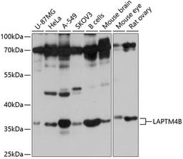 Western blot - LAPTM4B antibody (A10761)