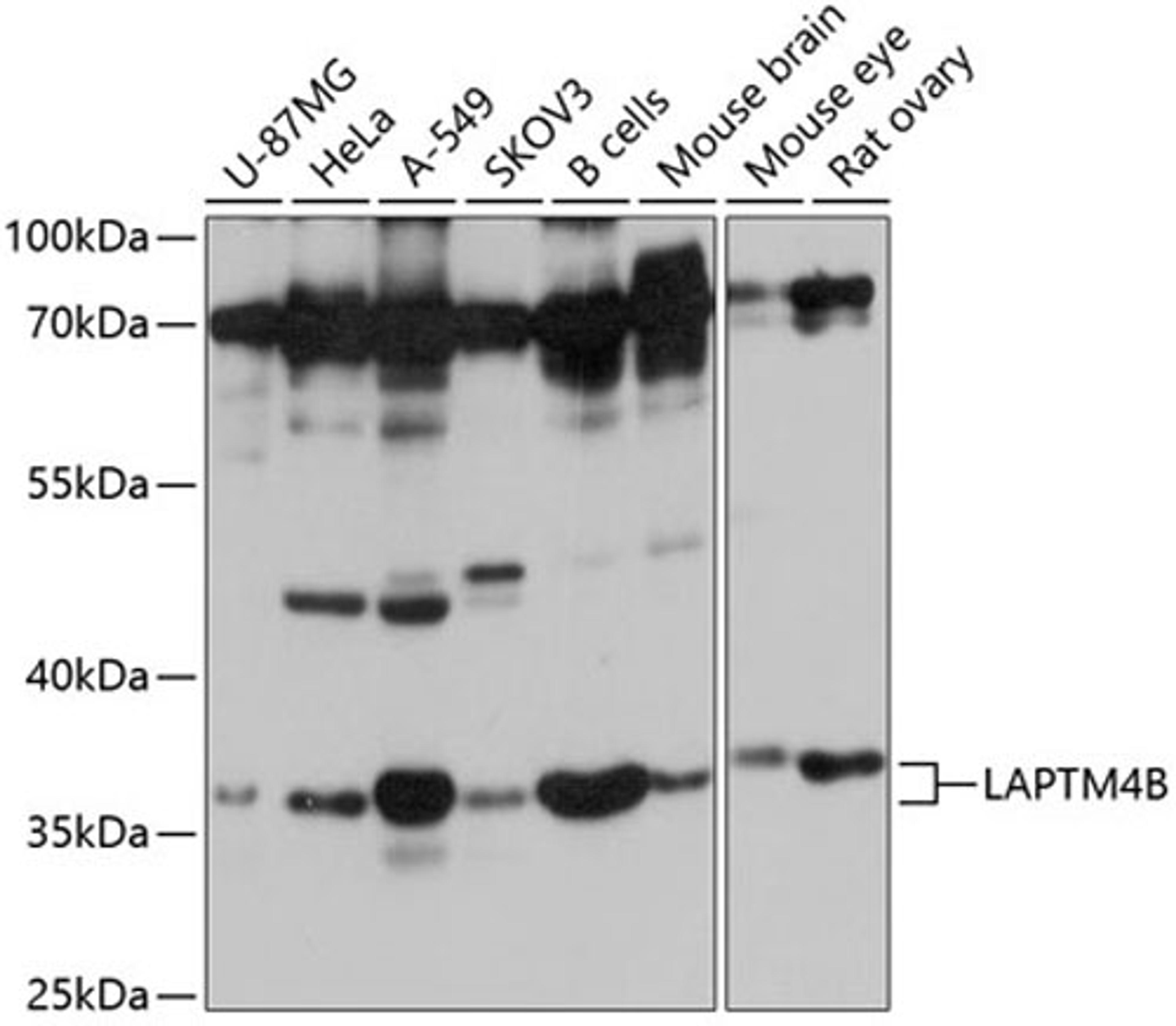 Western blot - LAPTM4B antibody (A10761)