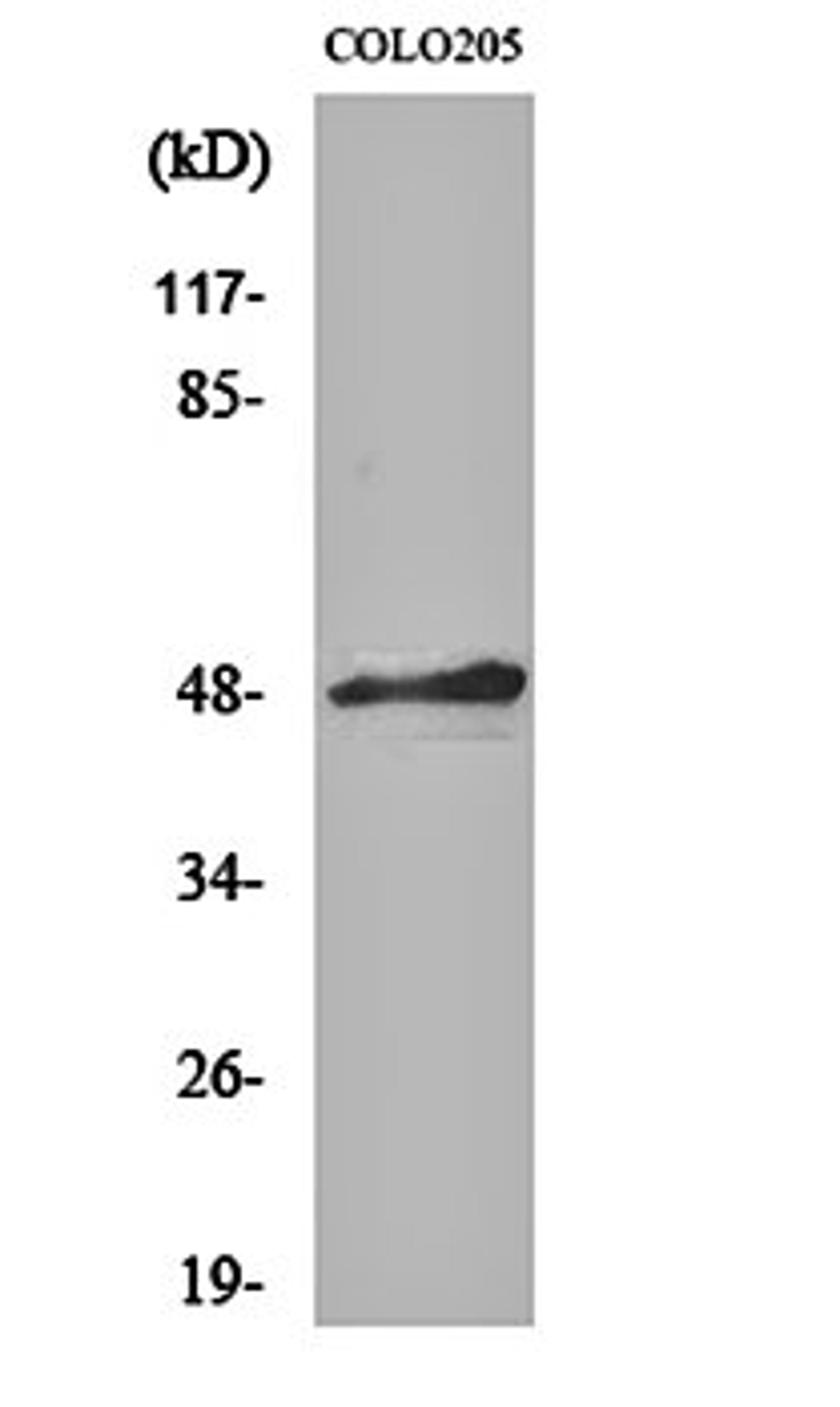 Western blot analysis of COLO205 cell lysates using AP-2 alpha/beta antibody