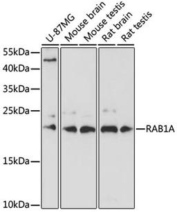 Western blot - RAB1A antibody (A17364)