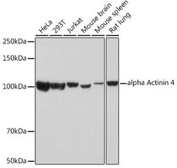 Western blot - alpha Actinin 4 Rabbit mAb (A3379)
