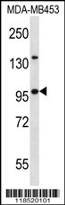 Western blot analysis in MDA-MB453 cell line lysates (35ug/lane).