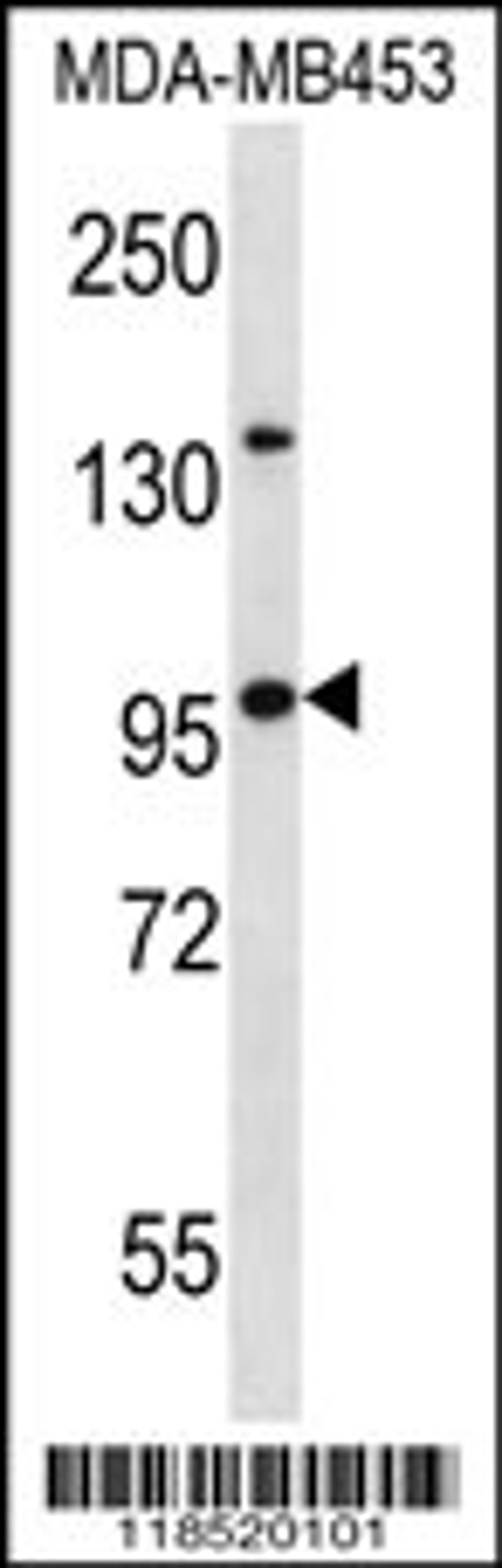 Western blot analysis in MDA-MB453 cell line lysates (35ug/lane).