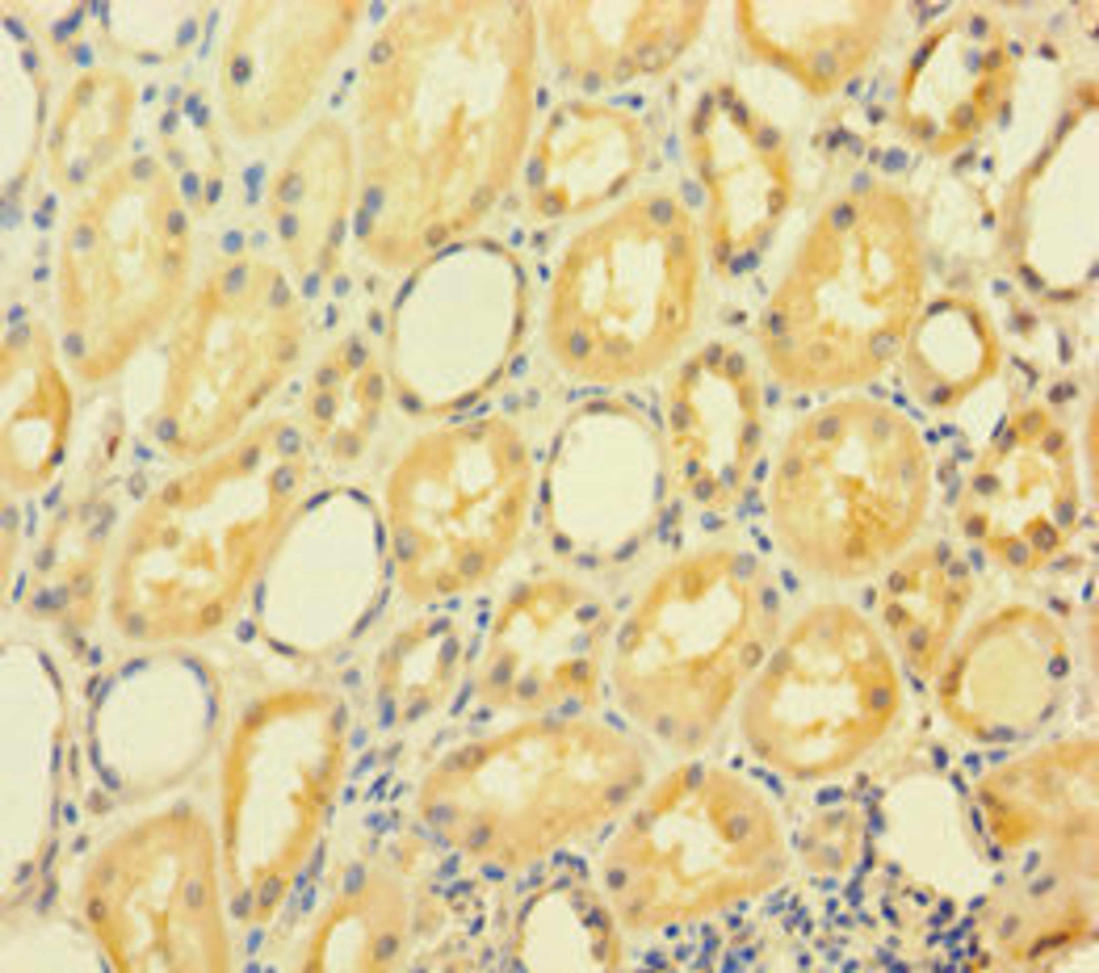 Immunohistochemistry of paraffin-embedded human kidney tissue using CSB-PA750350LA01HU at dilution of 1:100