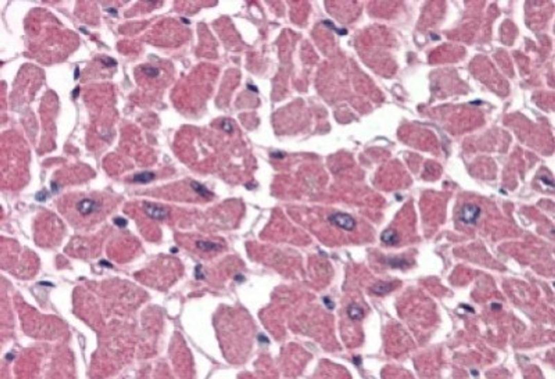 Immunohistochemistry-Paraffin: BPOZ Antibody [NB100-836] - (3.8ug/ml) staining of paraffin embedded Human Heart. Steamed antigen retrieval with citrate buffer pH 6, AP-staining.