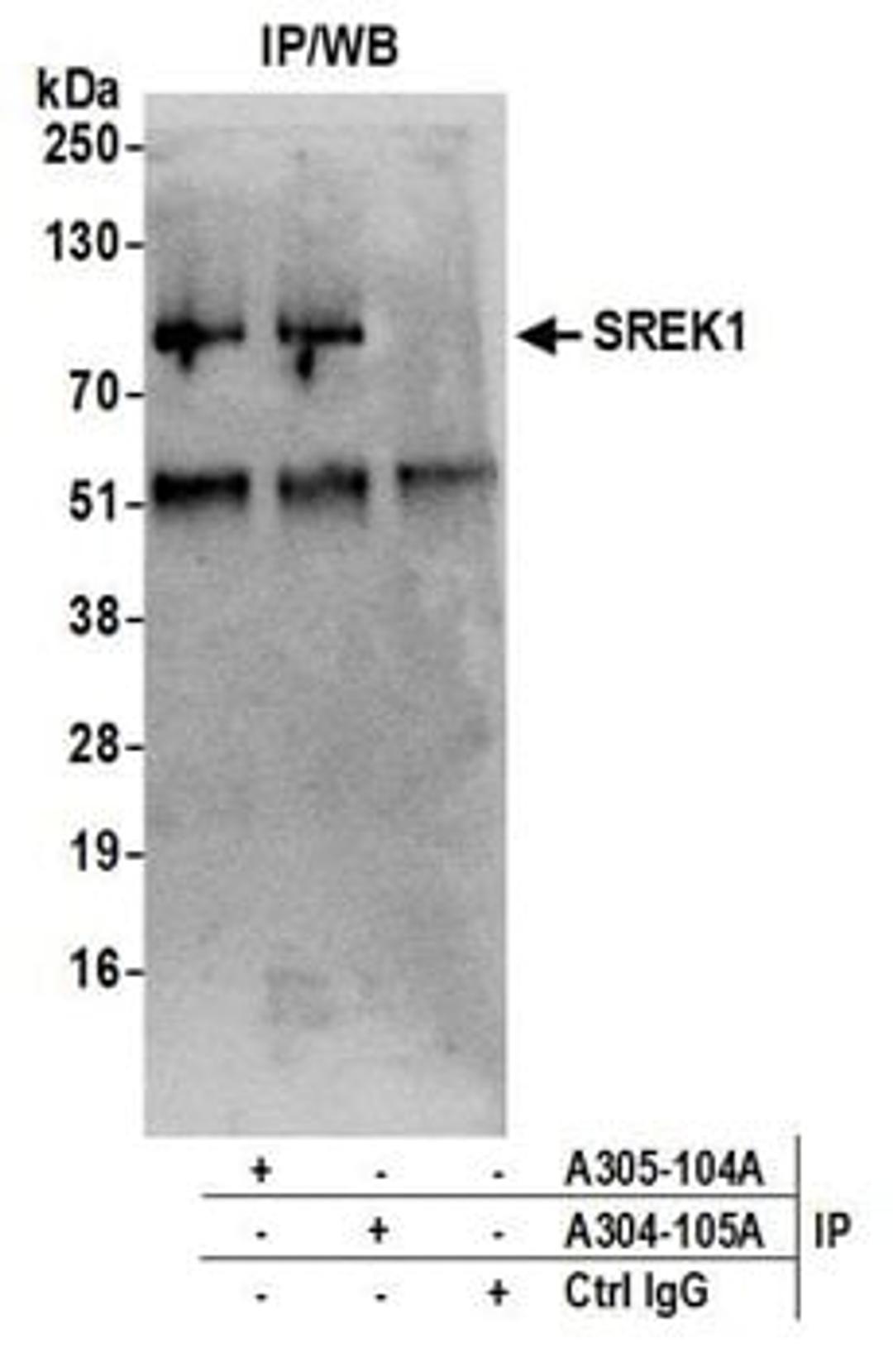 Detection of human SREK1 by western blot of immunoprecipitates.