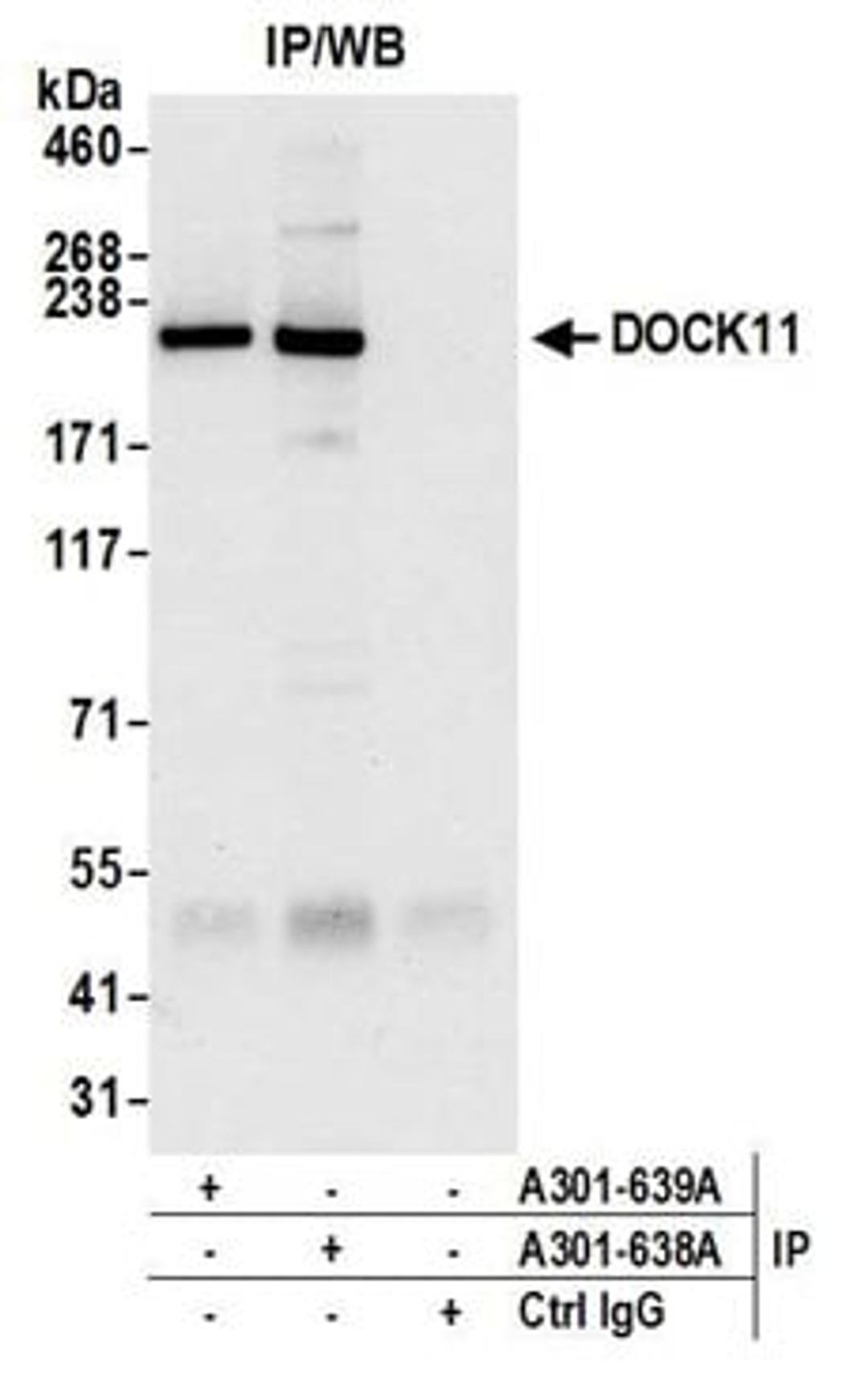 Detection of human DOCK11 by western blot of immunoprecipitates.