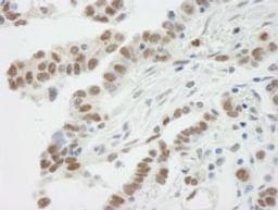 Detection of human BAF57/SMARCE1 by immunohistochemistry.