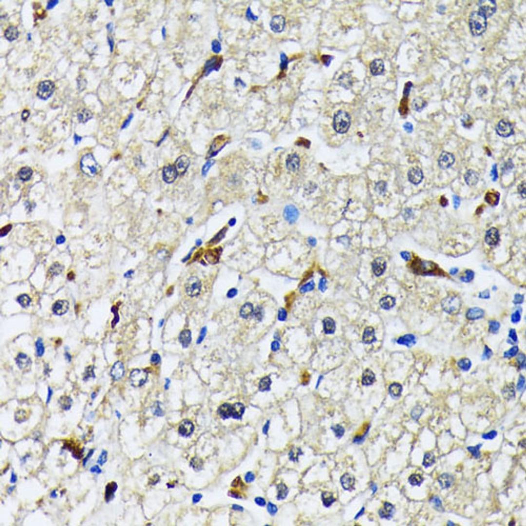 Immunohistochemistry  - CD68 antibody (A15037)