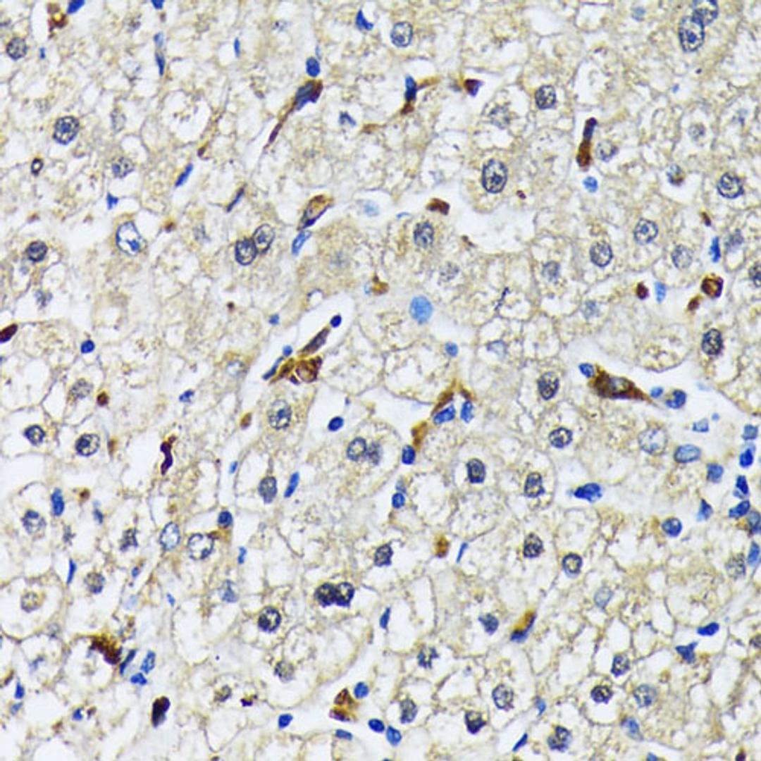 Immunohistochemistry - CD68 antibody (A15037)
