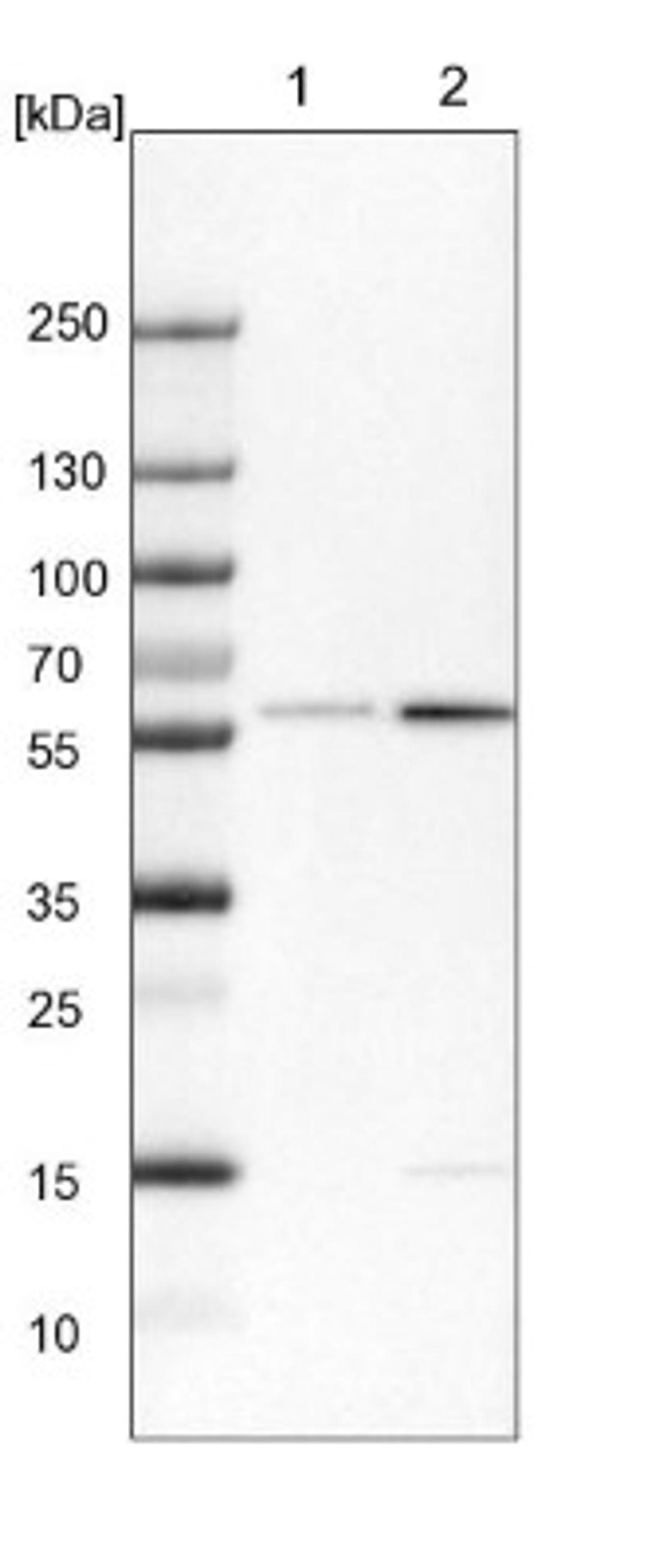 Western Blot: LEMD2 Antibody [NBP1-85175] - Lane 1: NIH-3T3 cell lysate (Mouse embryonic fibroblast cells)<br/>Lane 2: NBT-II cell lysate (Rat Wistar bladder tumour cells)