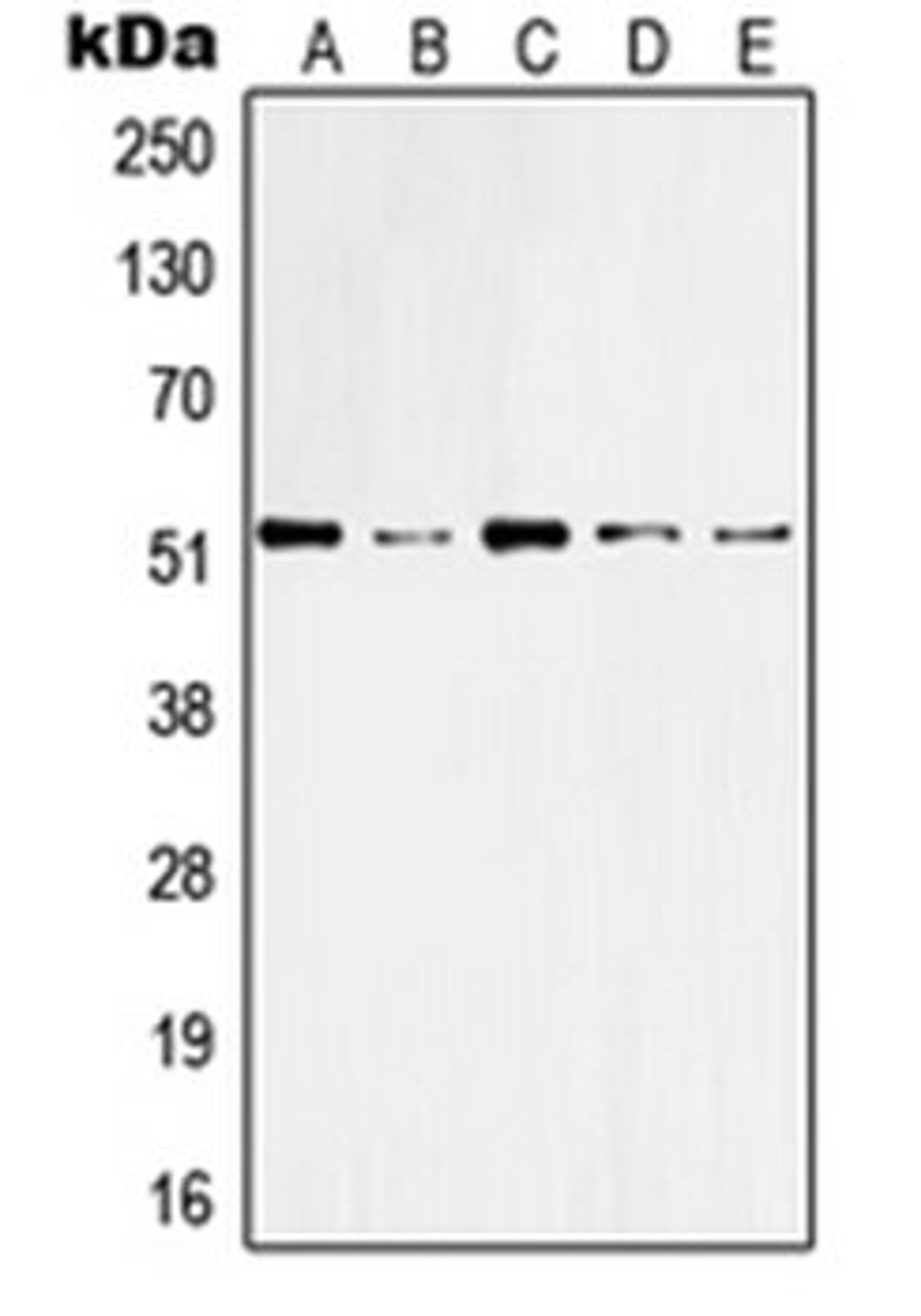 Western blot analysis of HeLa (Lane 1), A431 (Lane 2), Raw264.7 (Lane 3), NIH3T3 (Lane 4), rat brain (Lane 5) whole cell lysates using KRT10 antibody