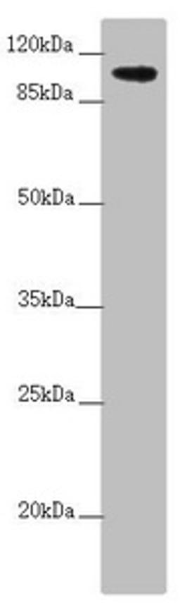 Western blot. All lanes: TTLL7 antibody at 2.6µg/ml + A549 whole cell lysate. Secondary. Goat polyclonal to rabbit IgG at 1/10000 dilution. Predicted band size: 103, 78, 93 kDa. Observed band size: 103 kDa