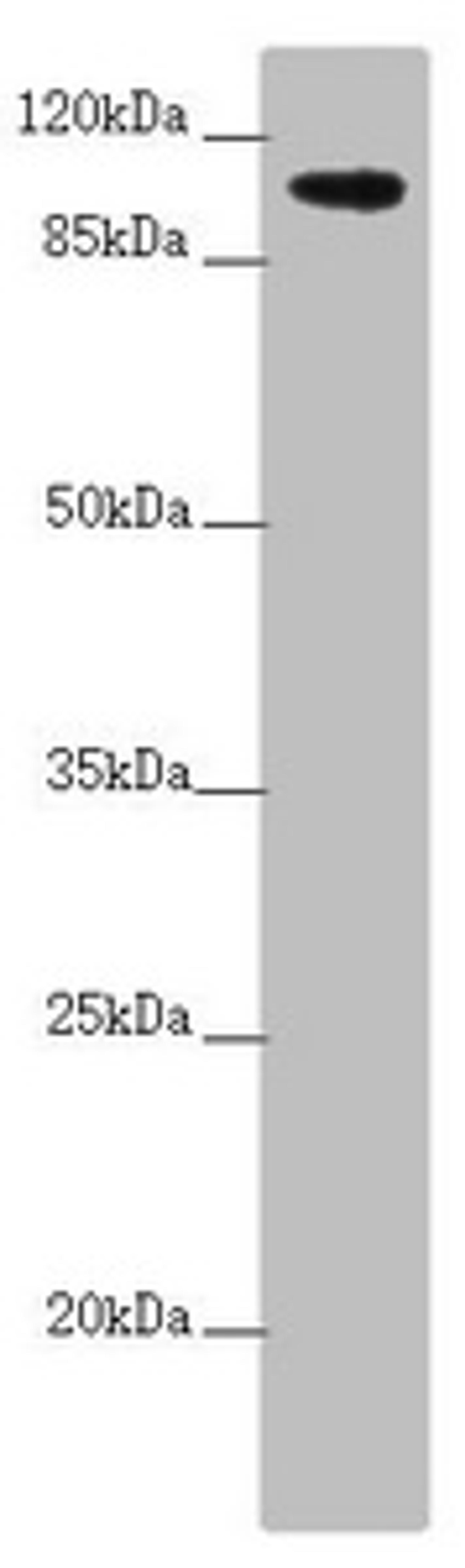 Western blot. All lanes: TTLL7 antibody at 2.6µg/ml + A549 whole cell lysate. Secondary. Goat polyclonal to rabbit IgG at 1/10000 dilution. Predicted band size: 103, 78, 93 kDa. Observed band size: 103 kDa