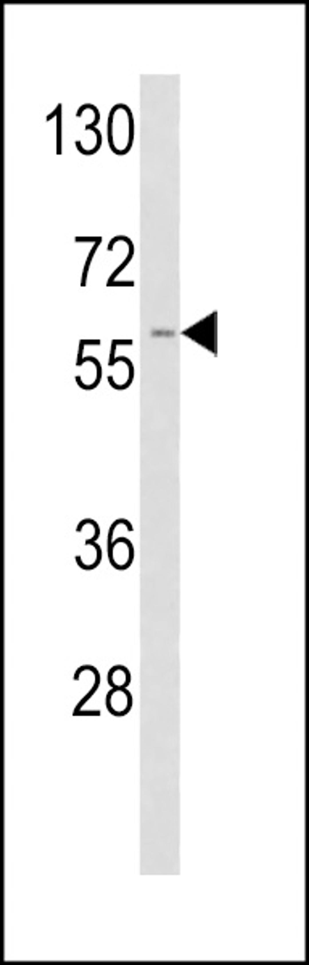 Western blot analysis of TPA Antibody in A2058 cell line lysates (35ug/lane)