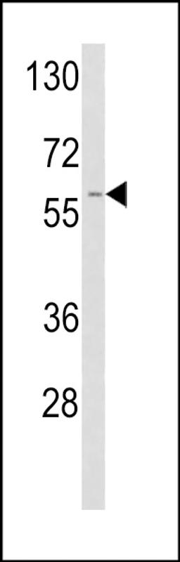 Western blot analysis of TPA Antibody in A2058 cell line lysates (35ug/lane)